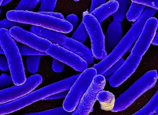 E. coli najčešće izaziva razvoj cistitisa kod žena